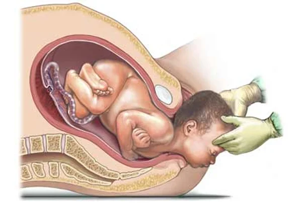 Ummeed Urology and Gynecology