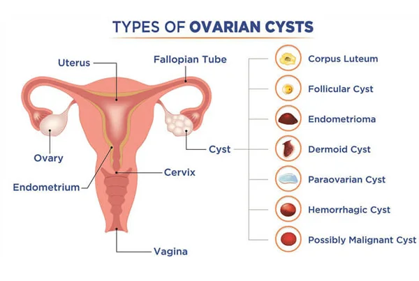 Ummeed Urology and Gynecology