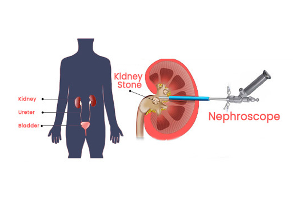 Ummeed Urology and Gynecology