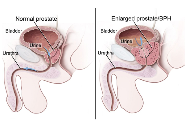 Ummeed Urology and Gynecology