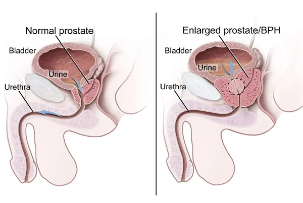 Ummeed Urology and Gynecology