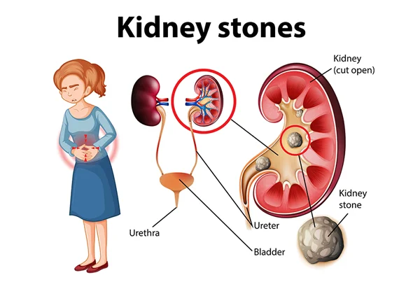Ummeed Urology and Gynecology