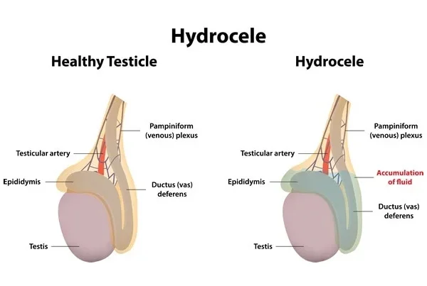 Ummeed Urology and Gynecology