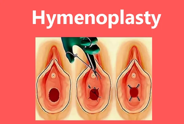 Ummeed Urology and Gynecology