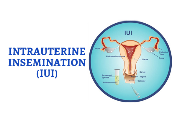 Ummeed Urology and Gynecology