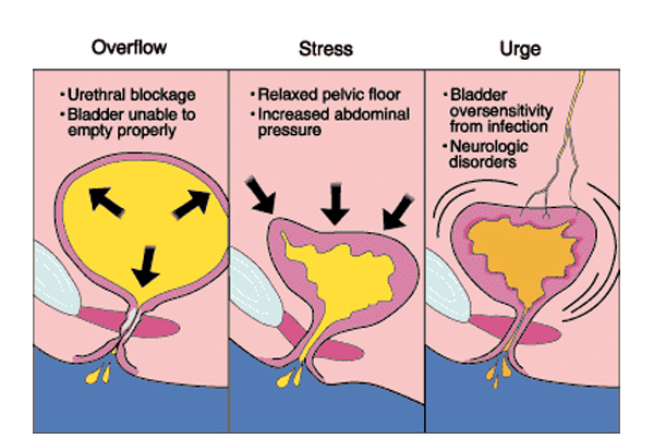 Ummeed Urology and Gynaecology