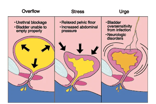 Ummeed Urology and Gynaecology