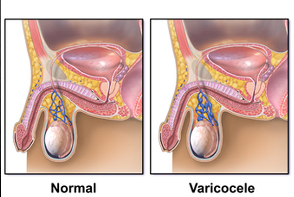 Ummeed Urology and Gynaecology